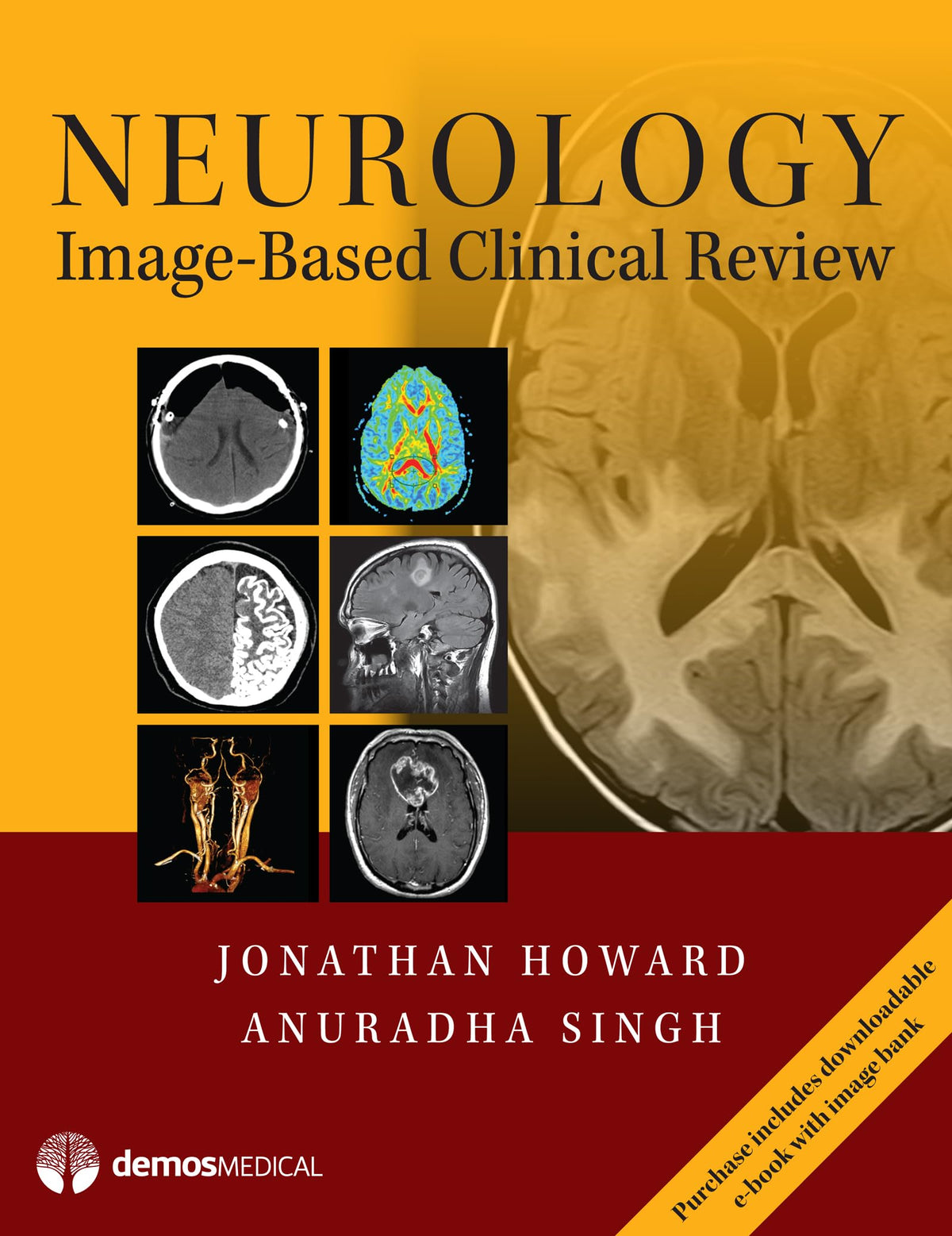 Neurology Image-Based Clinical Review: First Edition