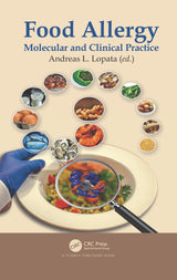 Food Allergy: 1st Edition
