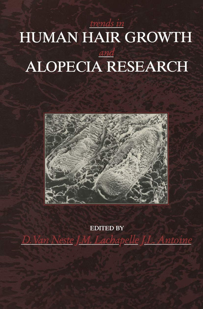 Trends in Human Hair Growth and Alopecia Research: 1st Edition