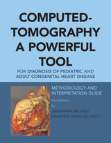 Computed-Tomography a Powerful Tool for Diagnosis of Pediatric and Adult Congenital Heart Disease: Methodology and Interpretation Guide