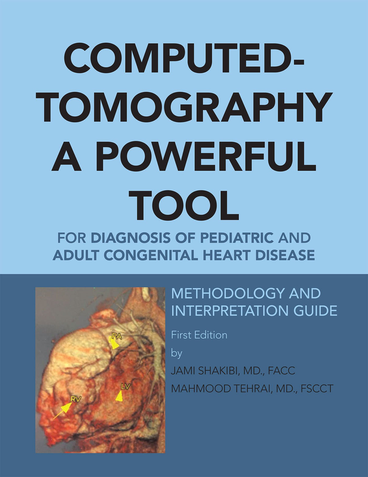 Computed-Tomography a Powerful Tool for Diagnosis of Pediatric and Adult Congenital Heart Disease: Methodology and Interpretation Guide