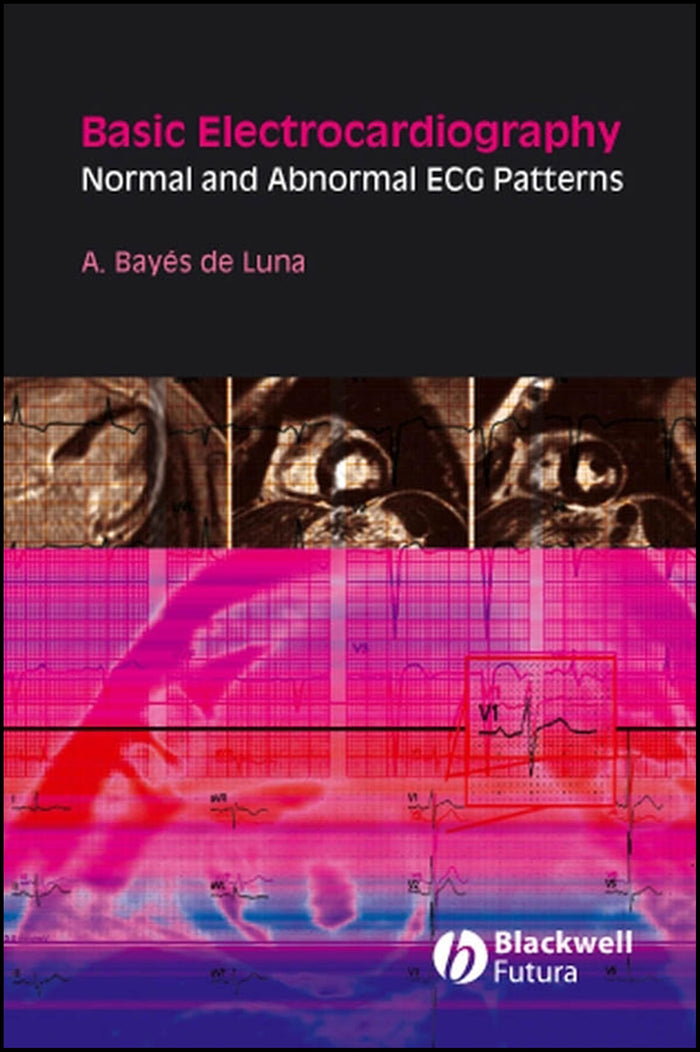 Basic Electrocardiography: Normal and Abnormal ECG Patterns