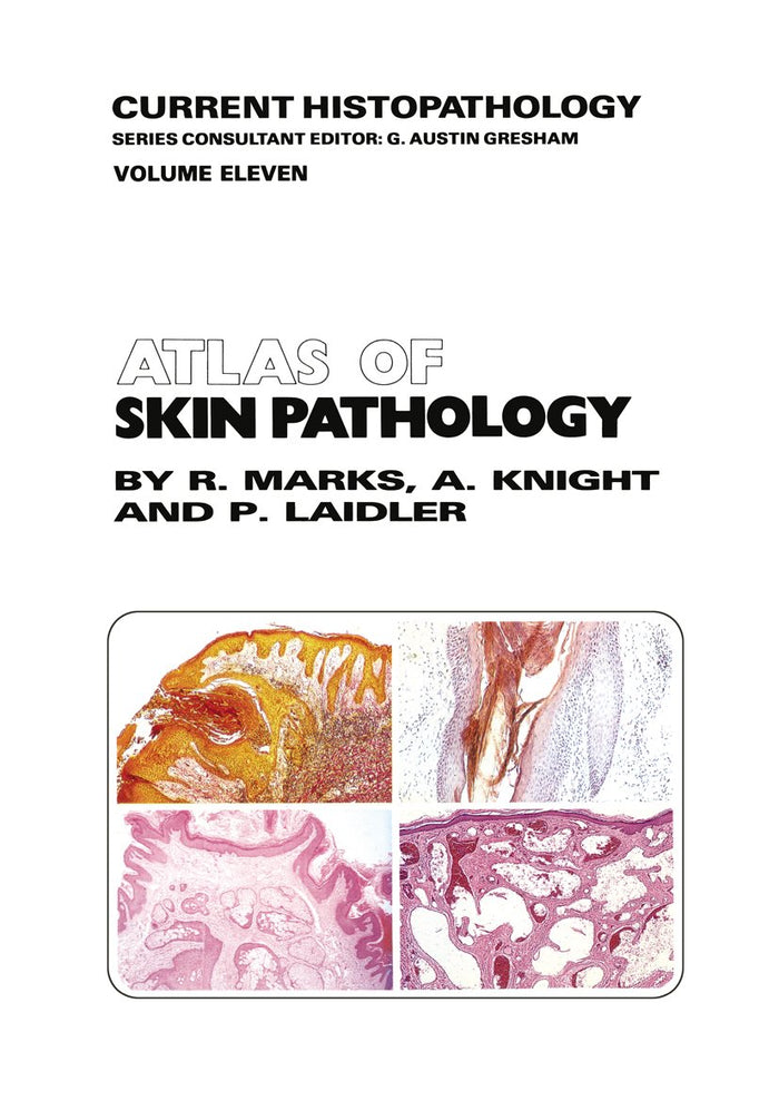 Atlas of Skin Pathology (Current Histopathology Book 11): 1st Edition