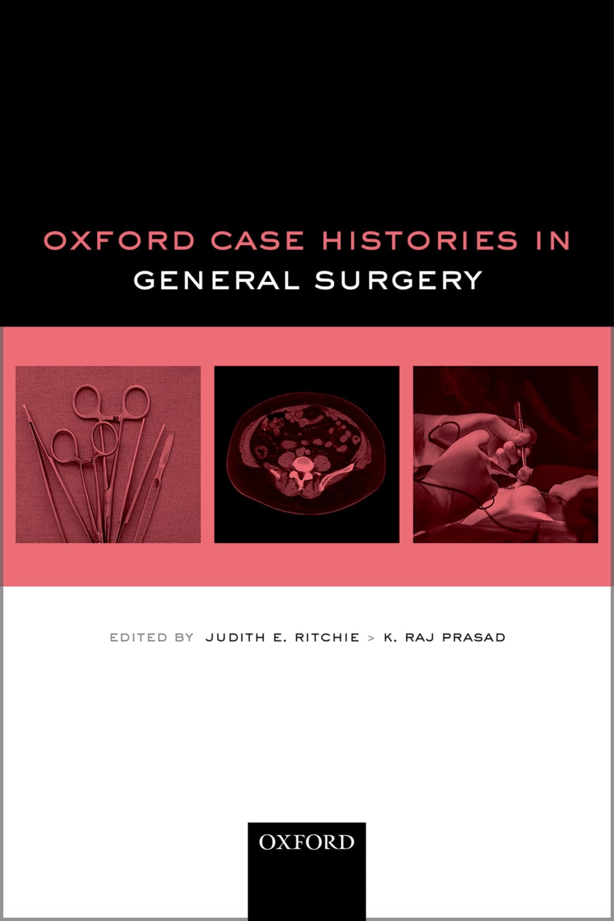 Oxford Case Histories in General Surgery: Illustrated Edition, Kindle Edition
