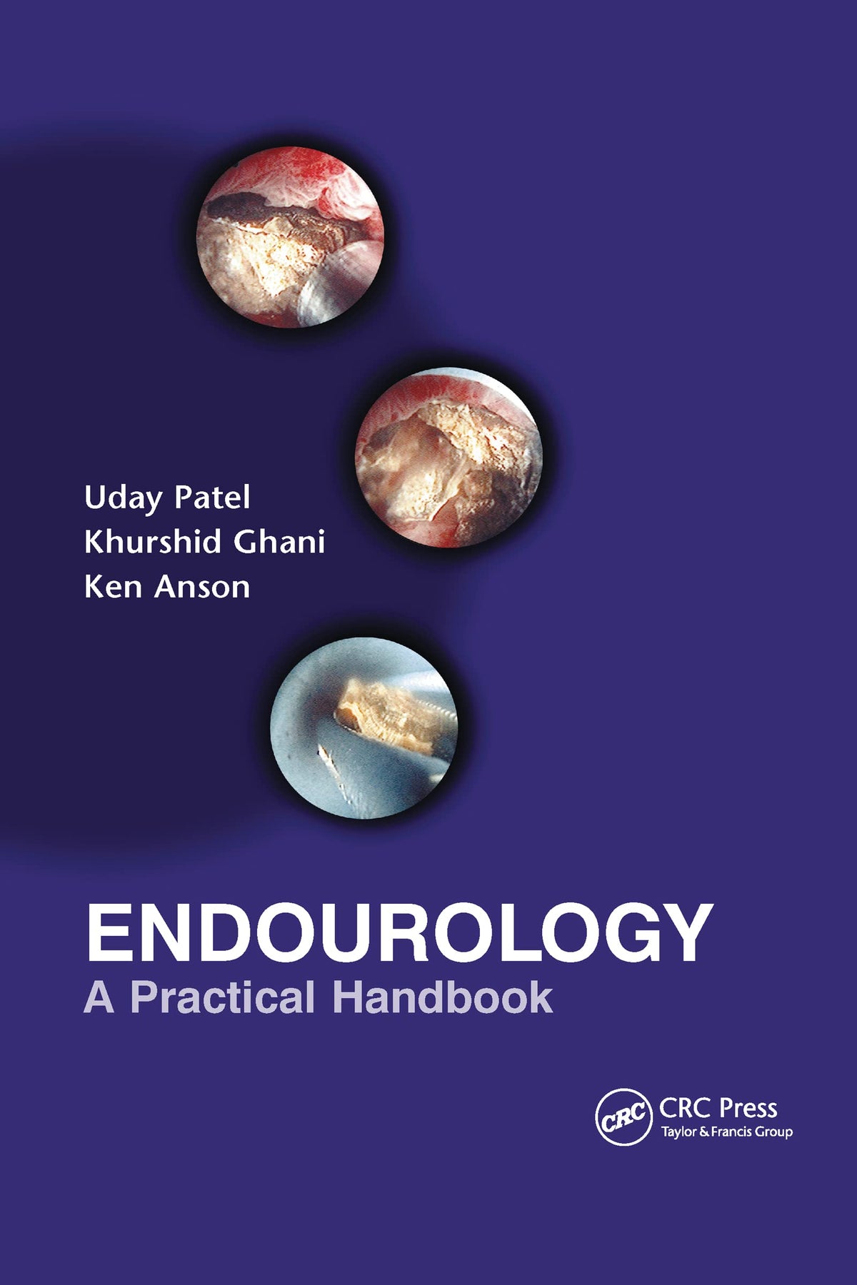 Endourology: 1st Edition