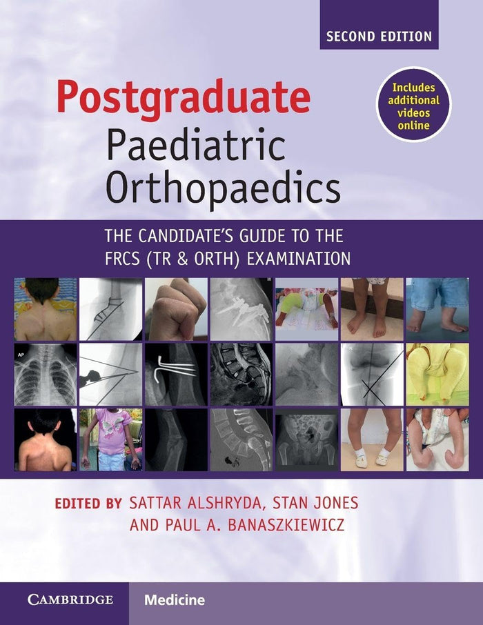 Postgraduate Paediatric Orthopaedics: 2nd Edition