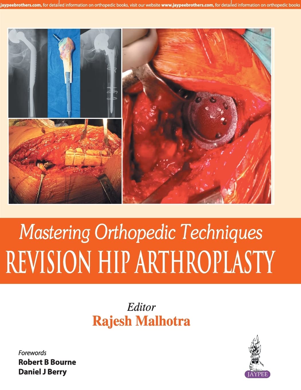 Mastering Orthopedic Techniques: Revision Hip Arthroplasty
