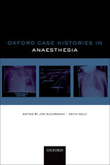 Oxford Case Histories in Anaesthesia: UK ed. Edition, Kindle Edition