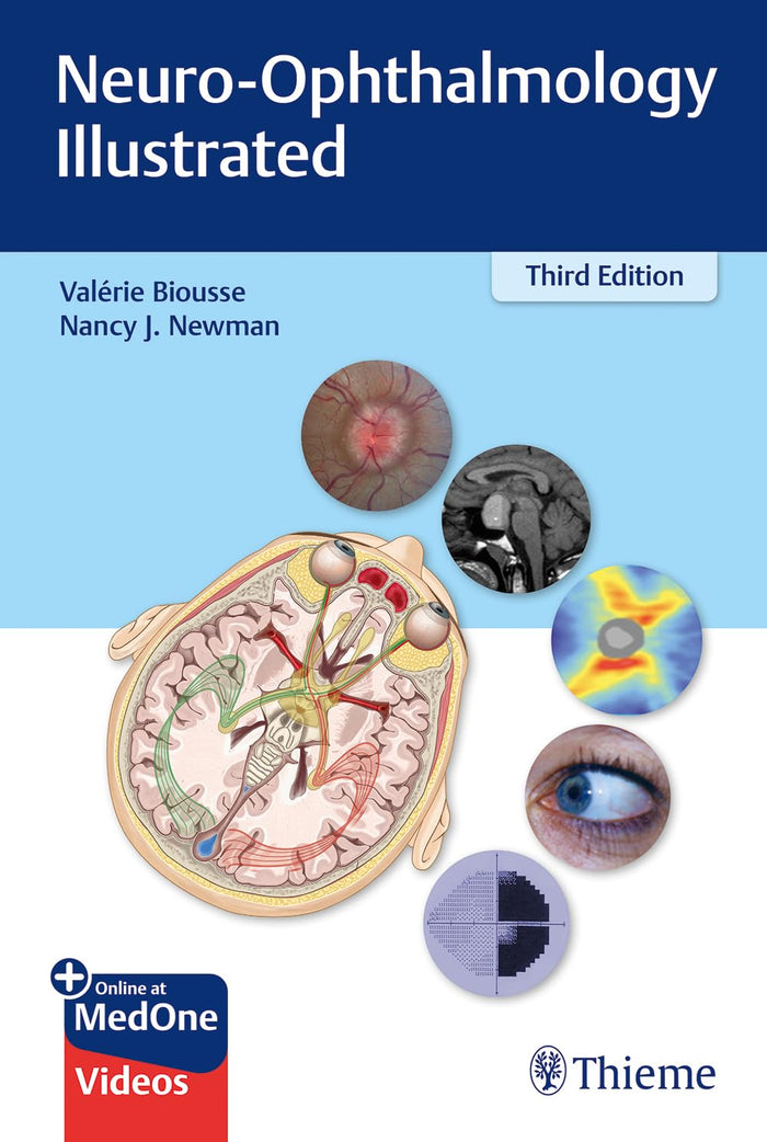 Neuro-Ophthalmology Illustrated: 3rd Edition