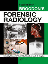 Brogdon's Forensic Radiology: 2nd Edition