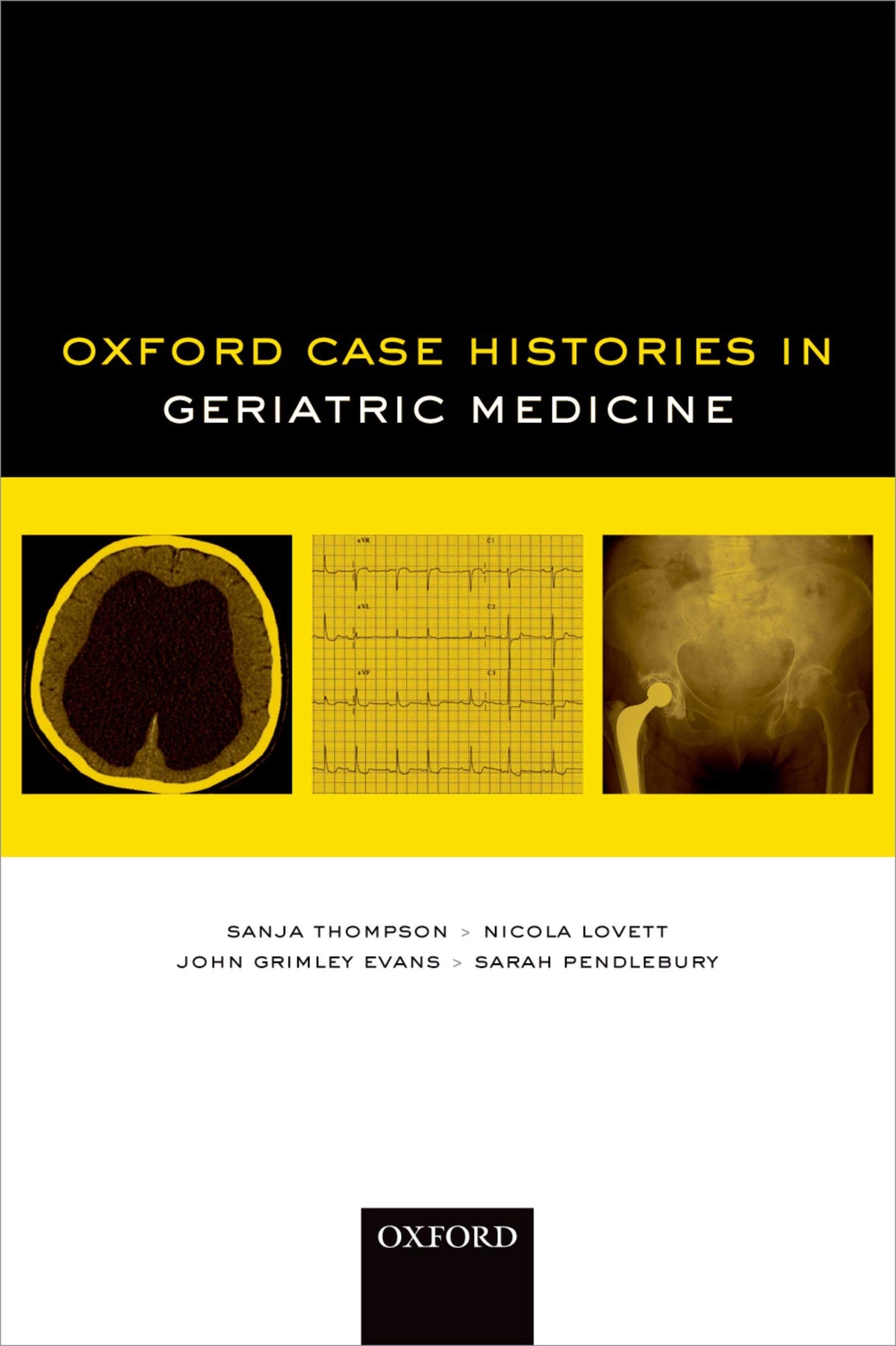 Oxford Case Histories in Geriatric Medicine: 1st Edition