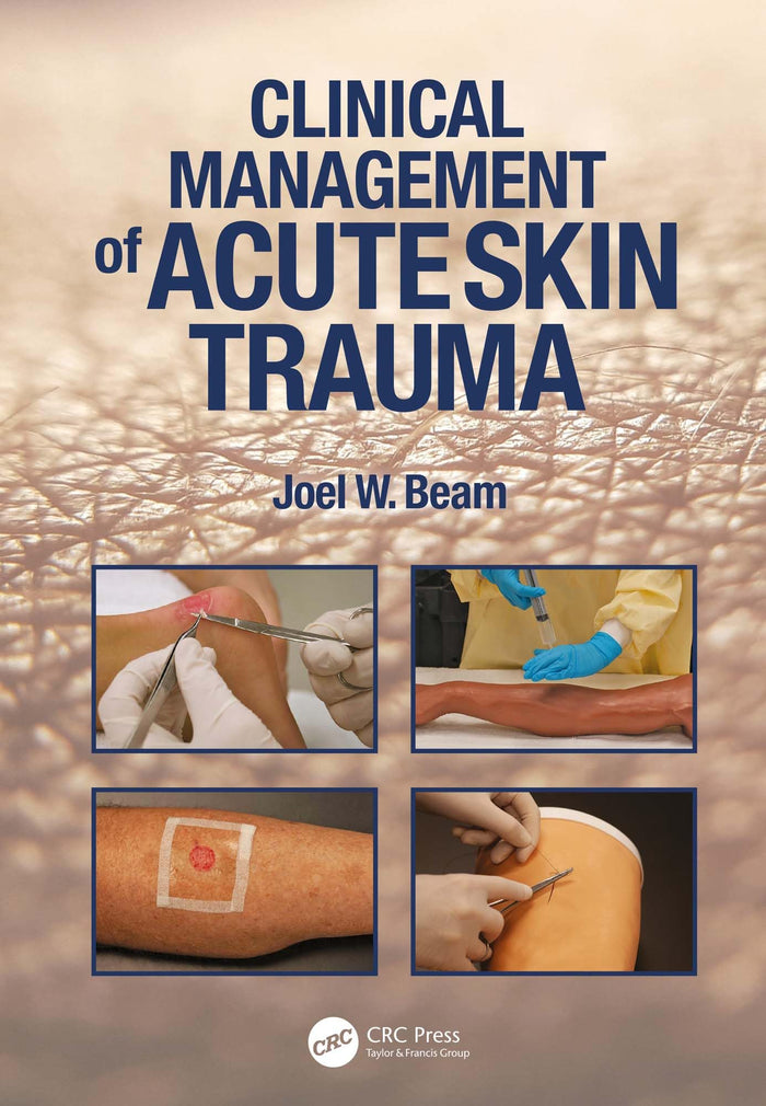 Clinical Management of Acute Skin Trauma: 1st Edition