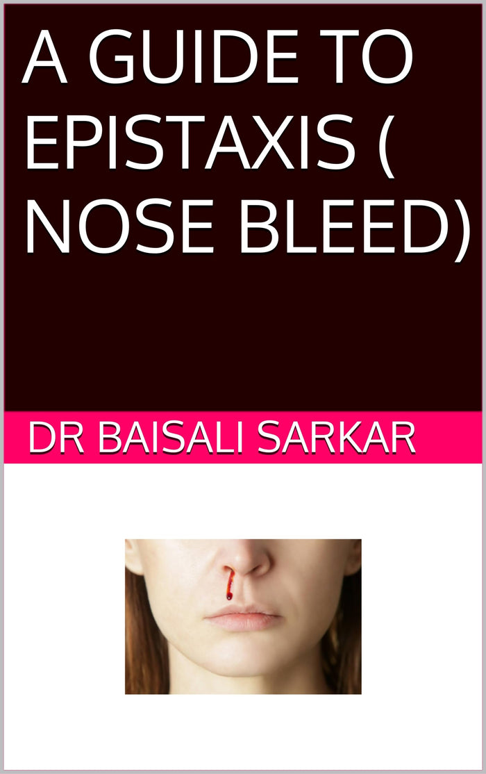 A GUIDE TO EPISTAXIS (NOSE BLEED)