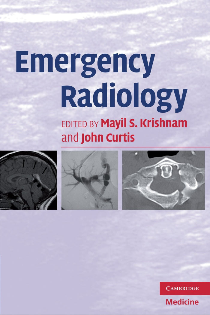 Emergency Radiology: 1st Edition
