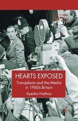 Hearts Exposed: Transplants and the Media in 1960s Britain (Science, Technology and Medicine in Modern History)