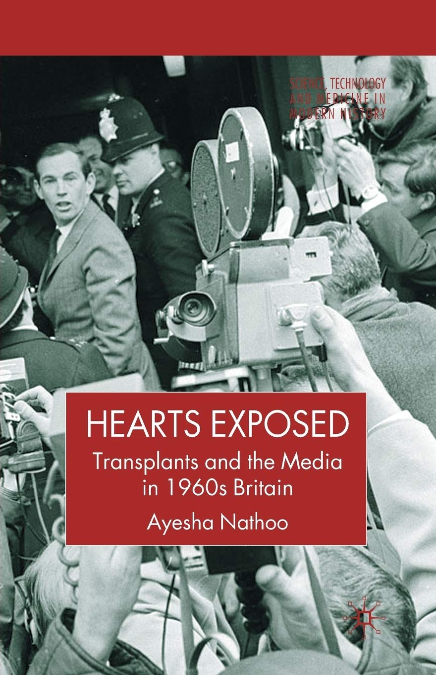 Hearts Exposed: Transplants and the Media in 1960s Britain (Science, Technology and Medicine in Modern History)