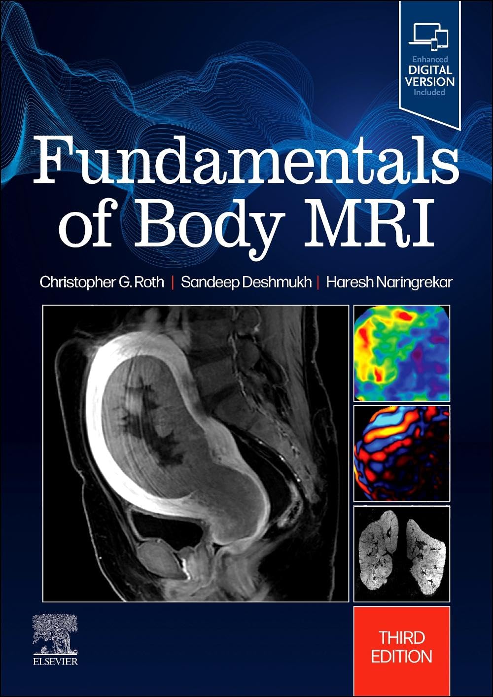 Fundamentals of Body MRI (Fundamentals of Radiology): 3rd Edition
