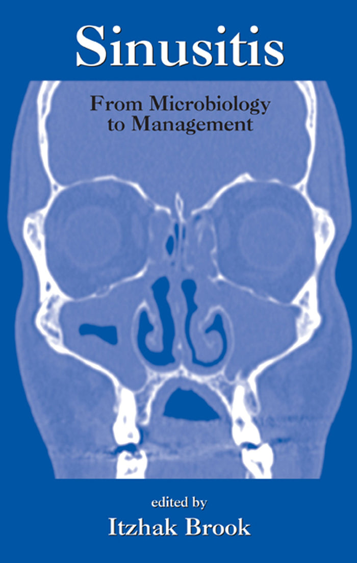Sinusitis: From Microbiology To Management (Infectious Disease and Therapy Book 35)