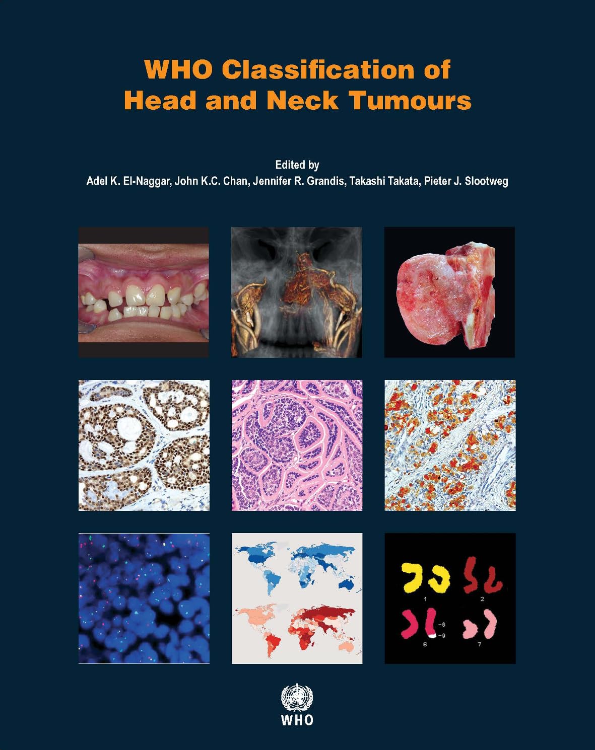 WHO Classification of Head and Neck Tumours [OP] (WHO Classification of Tumours): 4th Edition