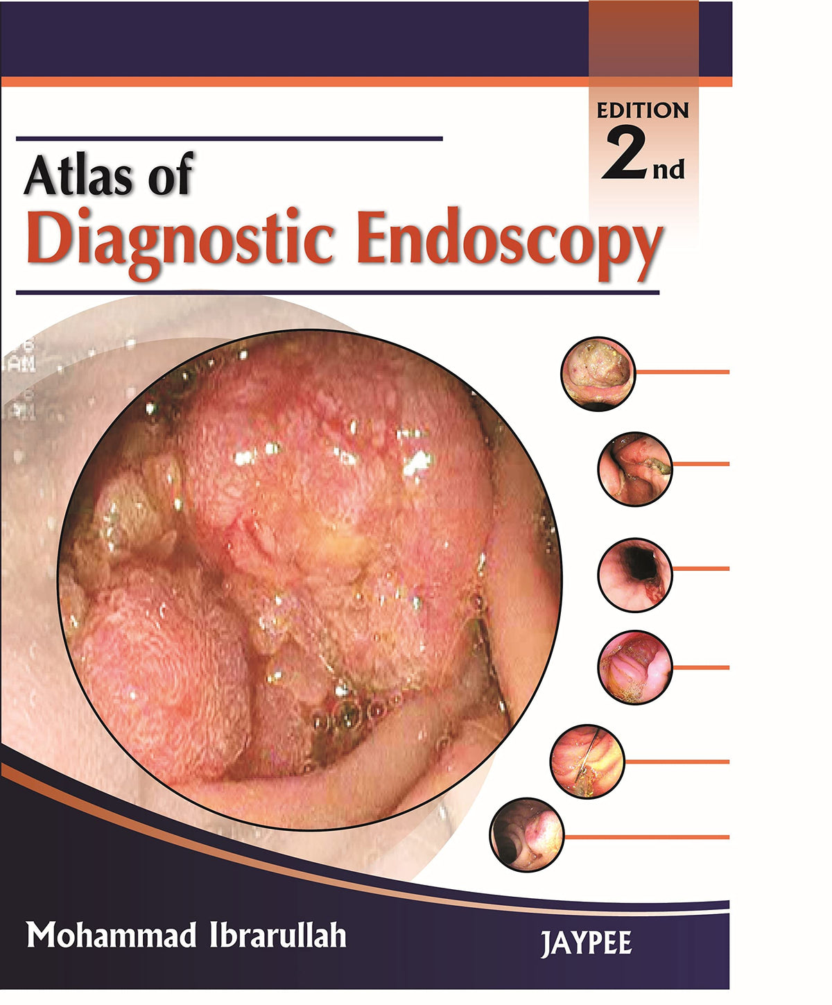 Atlas of Diagnostic Endoscopy: 2nd Edition