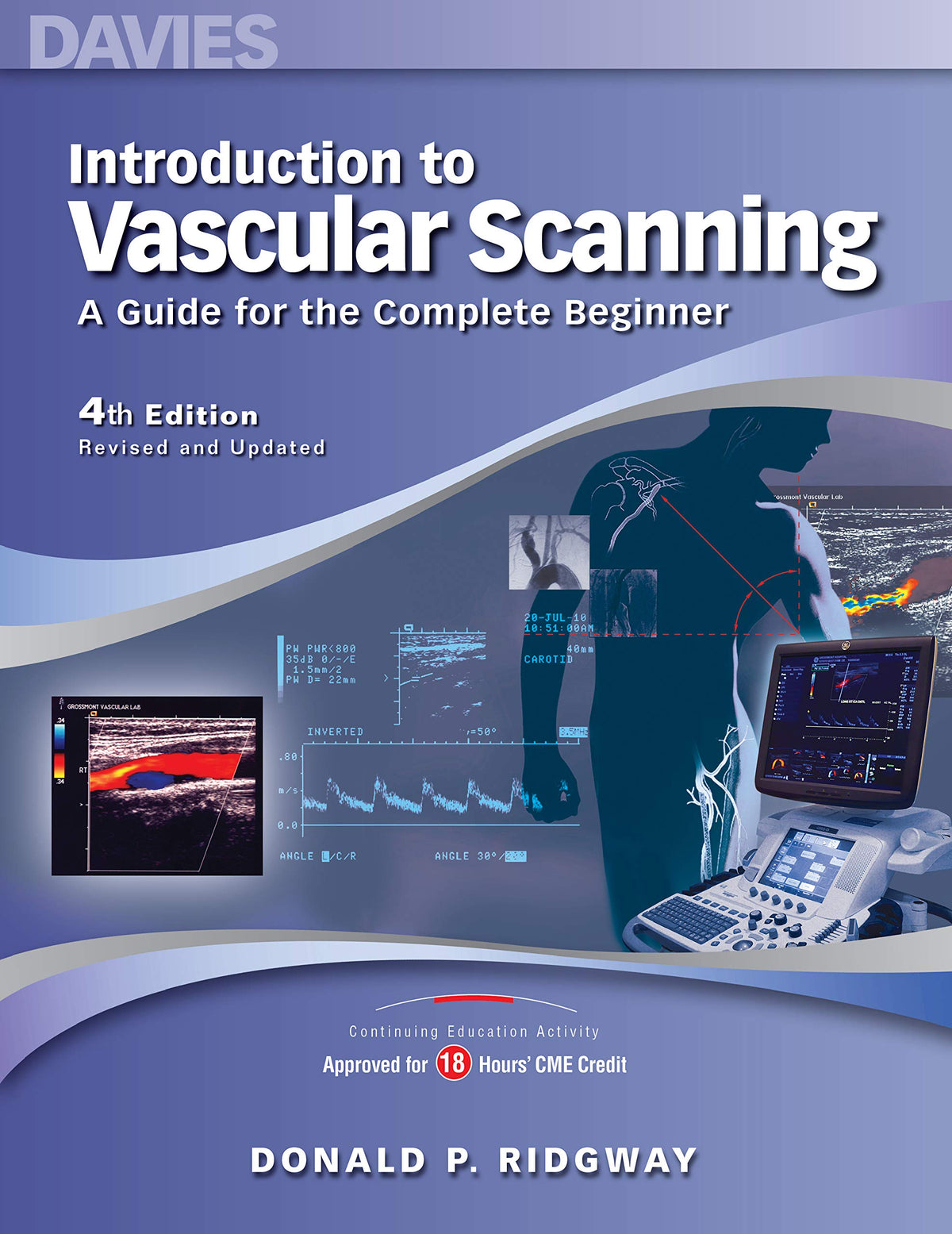Introduction to Vascular Scanning: A Guide for the Complete Beginner