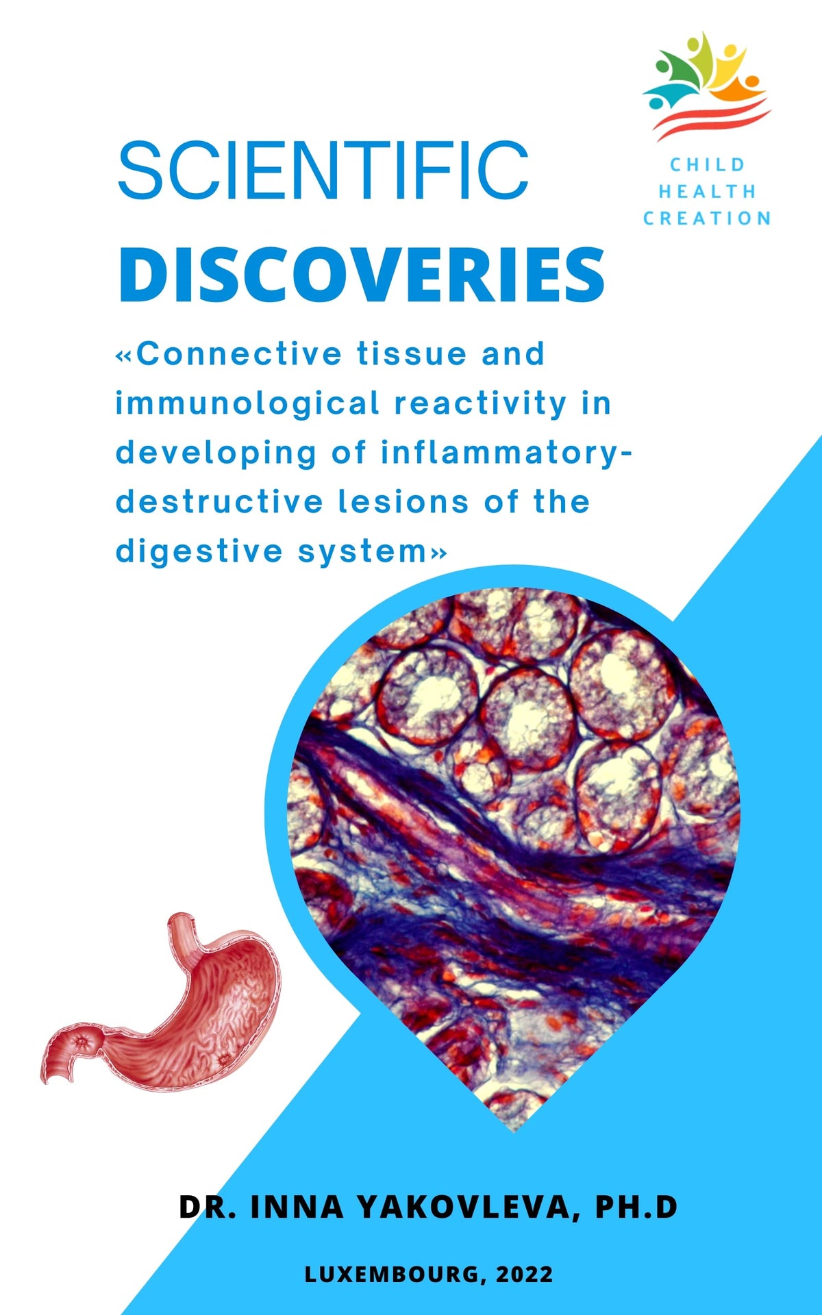Scientific Discoveries: Connective tissue and immunological reactivity in developing of inflammatory-destructive lesions of the digestive system