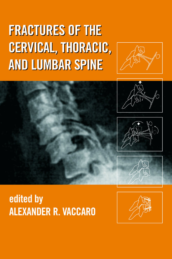 Fractures of the Cervical, Thoracic, and Lumbar Spine: 1st Edition