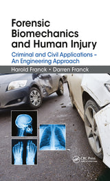 Forensic Biomechanics and Human Injury: 1st Edition