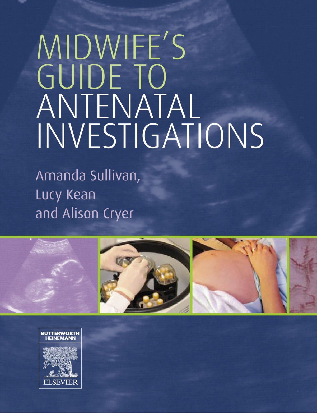 Midwife's Guide to Antenatal Investigations: 1st Edition