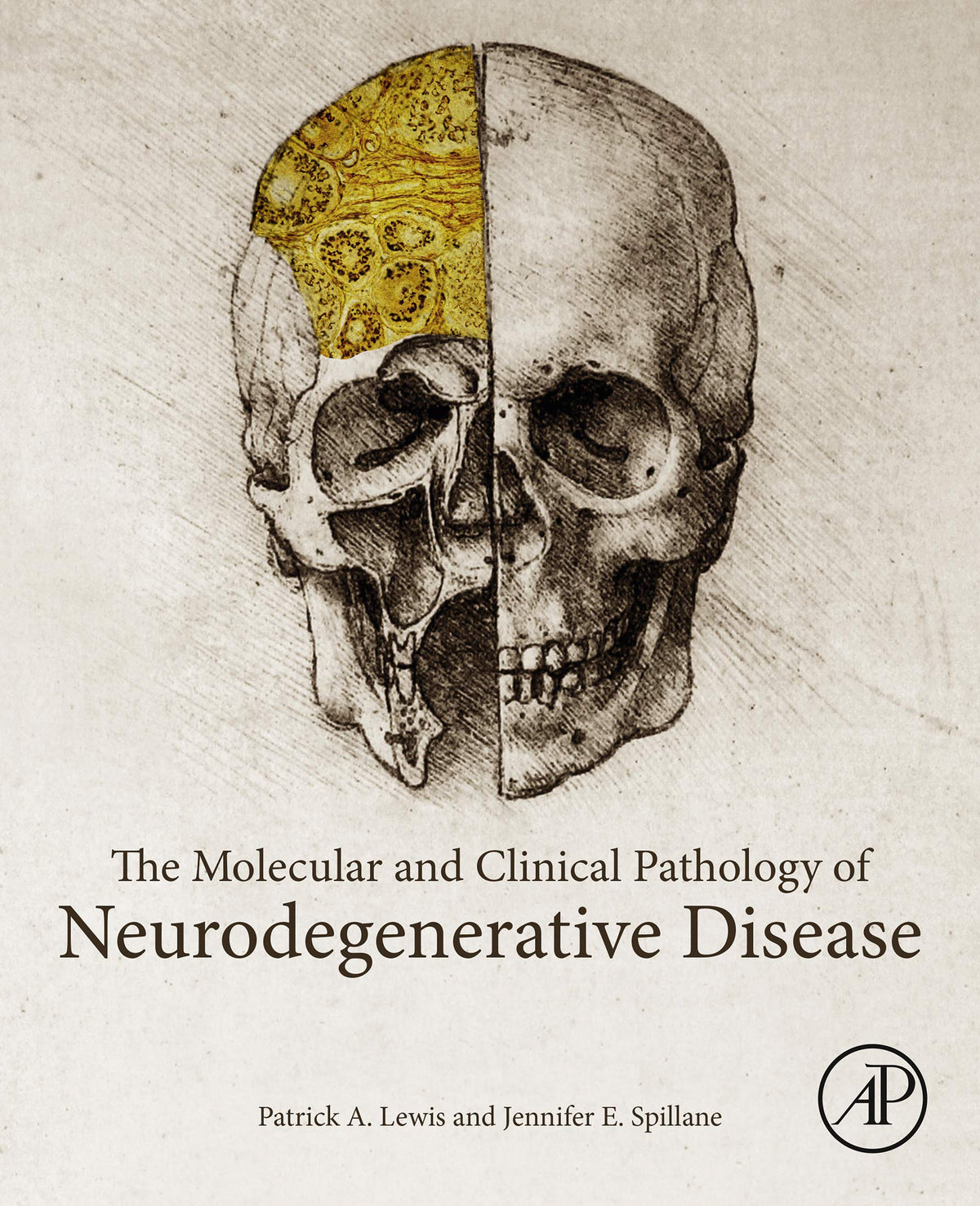 The Molecular and Clinical Pathology of Neurodegenerative Disease: 1st Edition