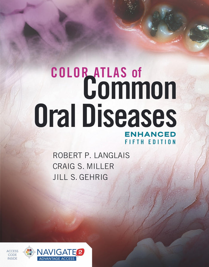 Color Atlas of Common Oral Diseases, Enhanced Edition: Paperback – Enhanced, June 15, 2020