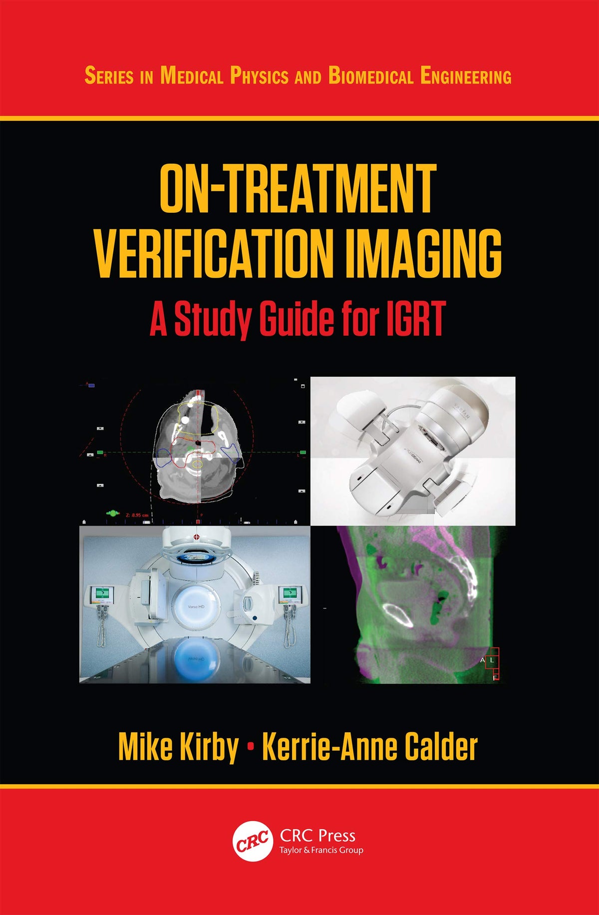 On-Treatment Verification Imaging: A for IGRT (Series in Medical Physics and Biomedical Engineering)