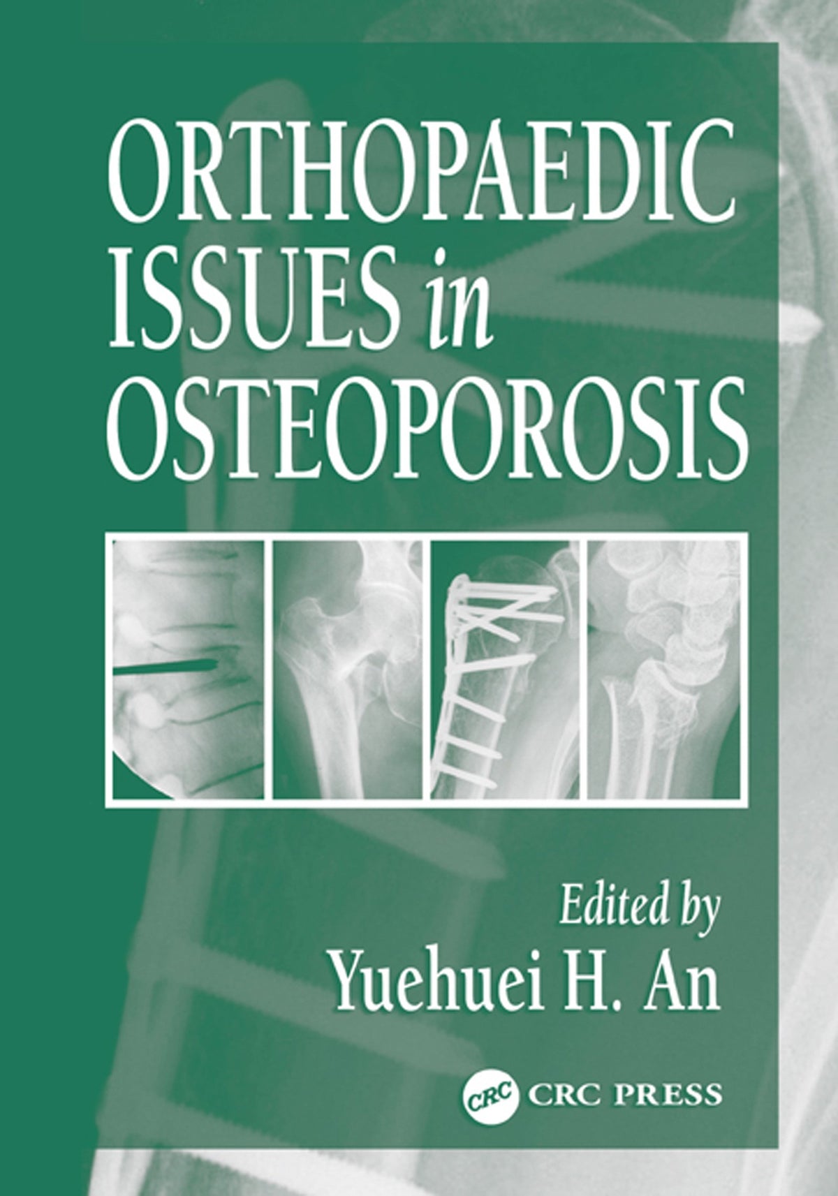 Orthopaedic Issues in Osteoporosis: 1st Edition