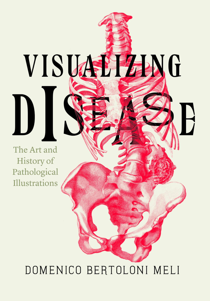 Visualizing Disease: The Art and History of Pathological Illustrations: Illustrated Edition, Kindle Edition