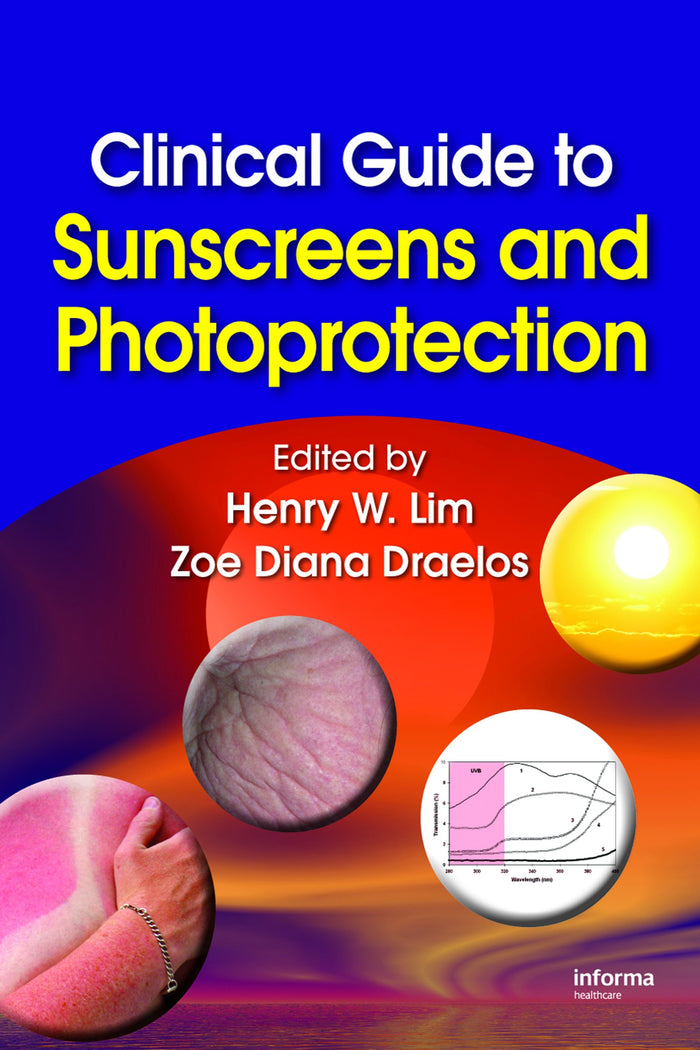 Clinical Guide to Sunscreens and Photoprotection: 1st Edition