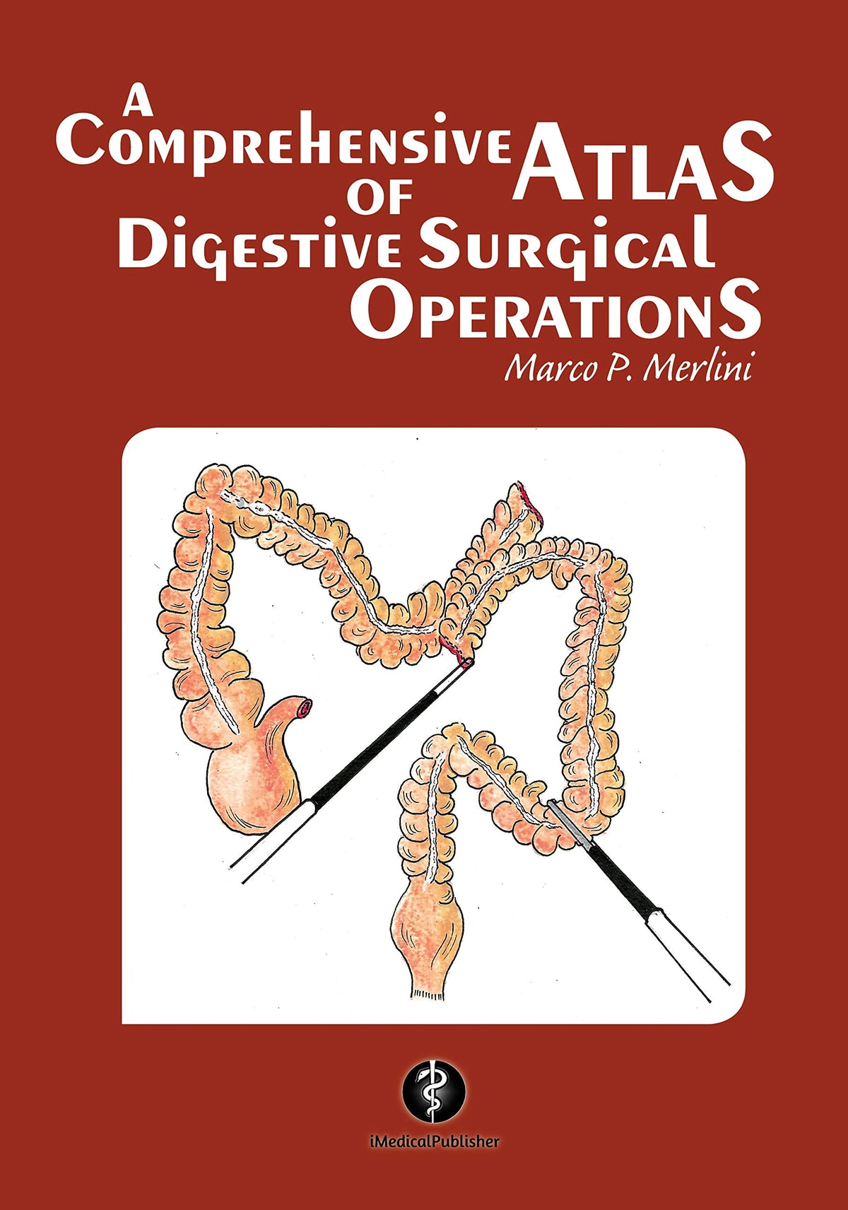 A Comprehensive Atlas of Digestive Surgical Operations: [Print Replica] Kindle Edition