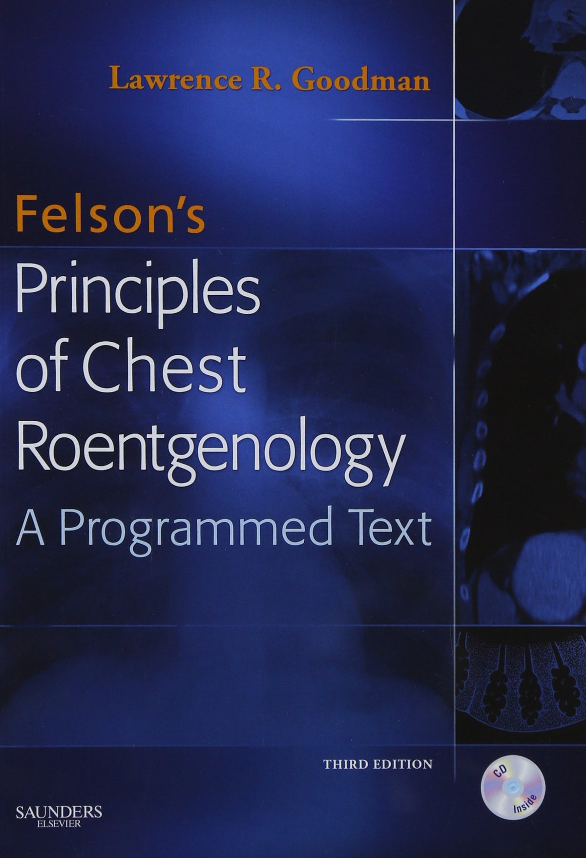 Felson's Principles of Chest Roentgenology Text with CD-ROM: 3rd Edition