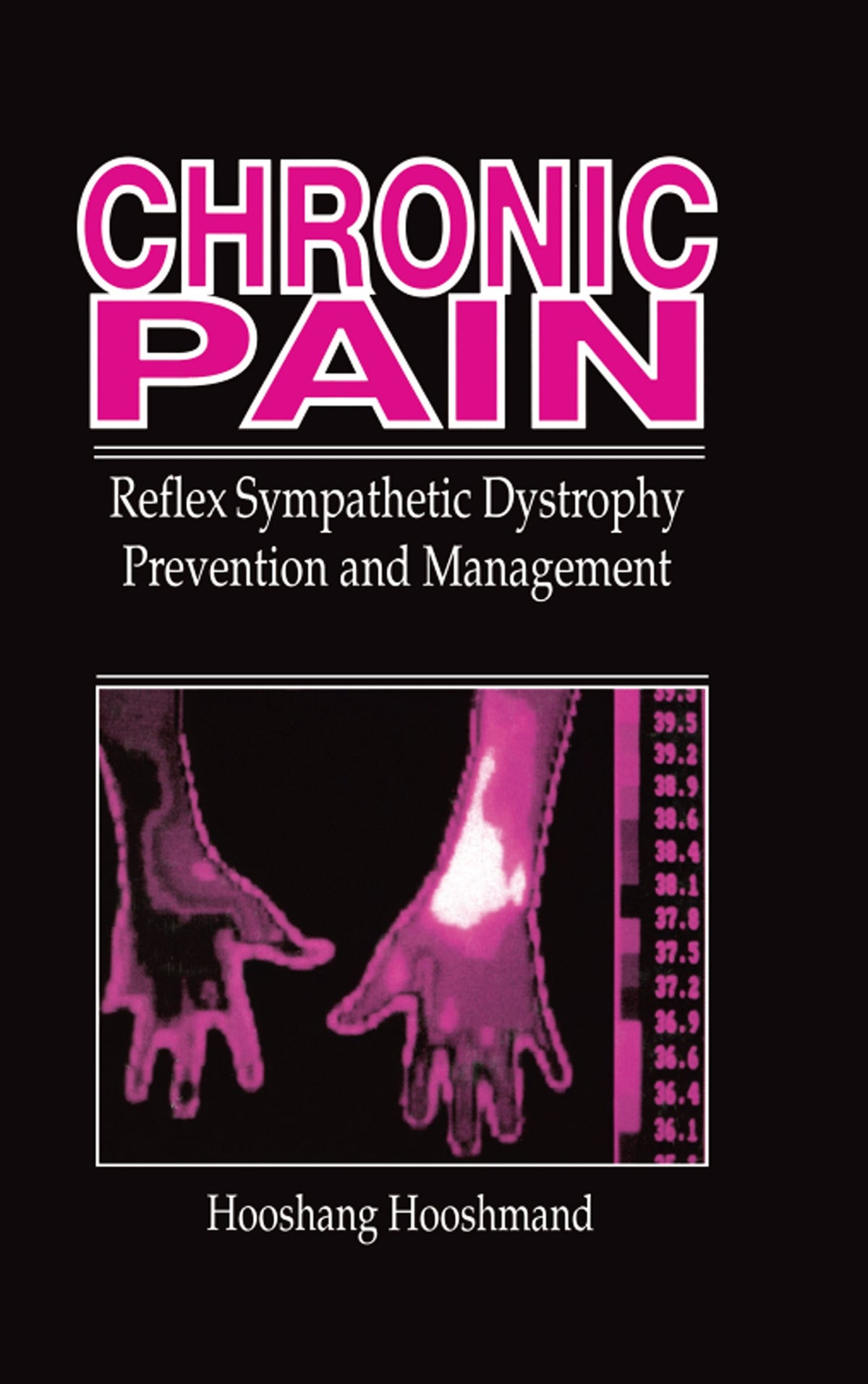 Chronic Pain: Reflex Sympathetic Dystrophy, Prevention, and Management