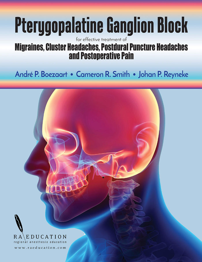 Pterygopalatine Ganglion Block: for effective treatment of Migraine, Cluster Headache, Postdural Puncture Headache & Postoper
