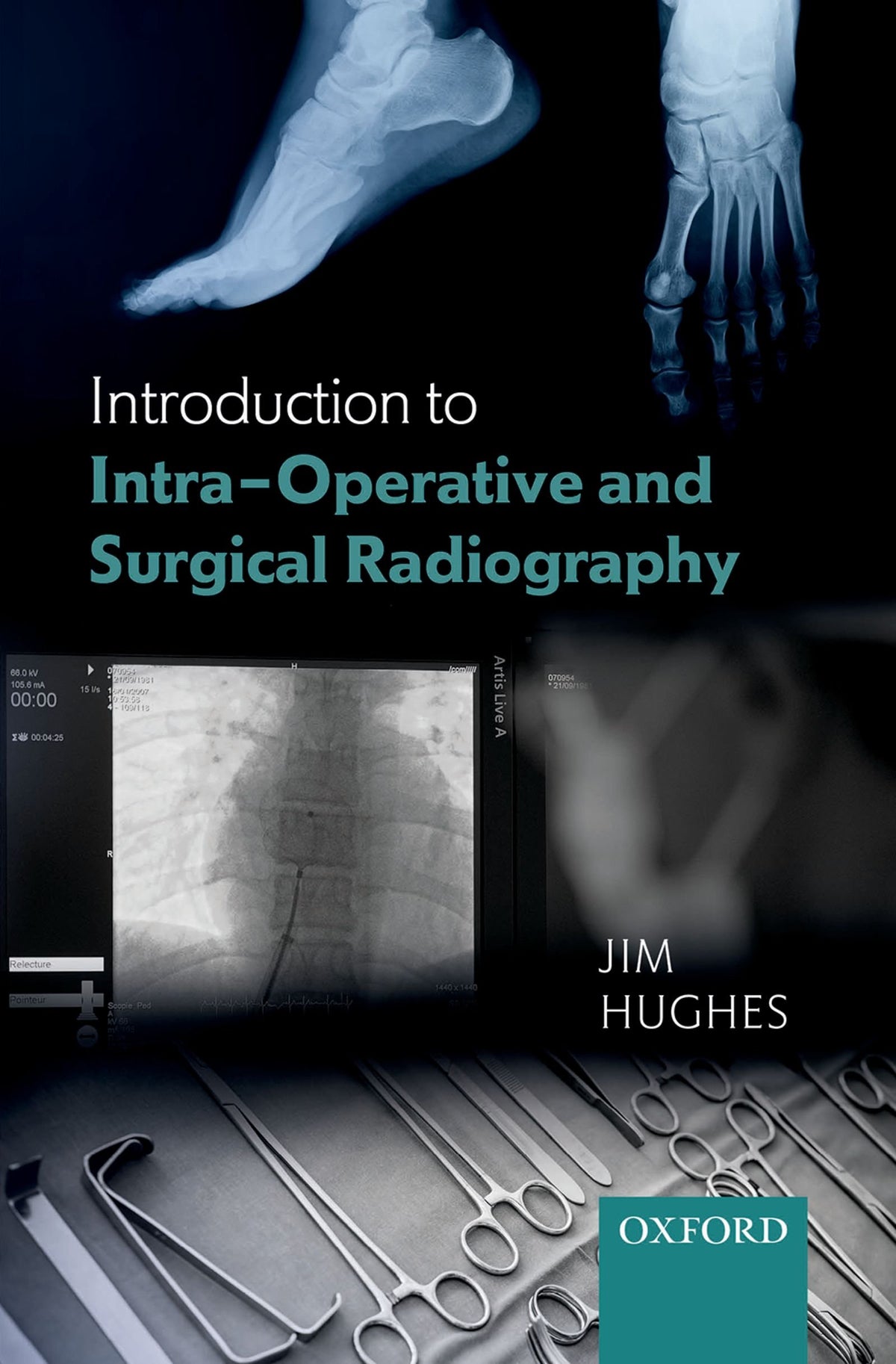 Introduction to Intra-Operative and Surgical Radiography: 1st Edition