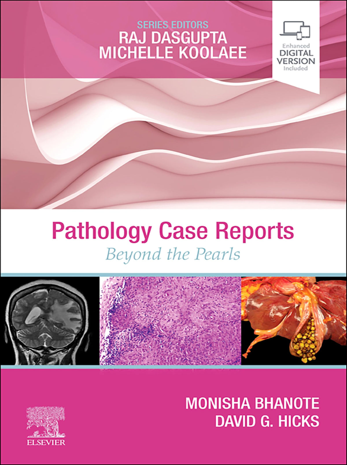 Pathology Case Reports,E-Book (Case Reports: Beyond the Pearls 1): 1st Edition, Kindle Edition