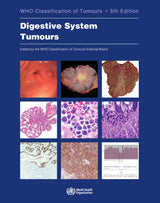 Digestive System Tumours: WHO Classification of Tumours (Medicine)
