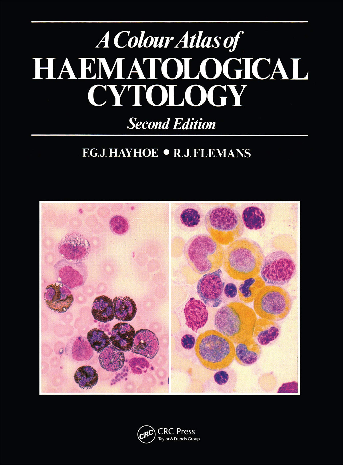 A Colour Atlas of Haematological Cytology (Wolfe Medical Atlases): 2nd Edition