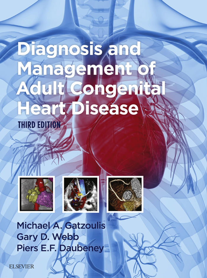 Diagnosis and Management of Adult Congenital Heart Disease E-Book: 3rd Edition