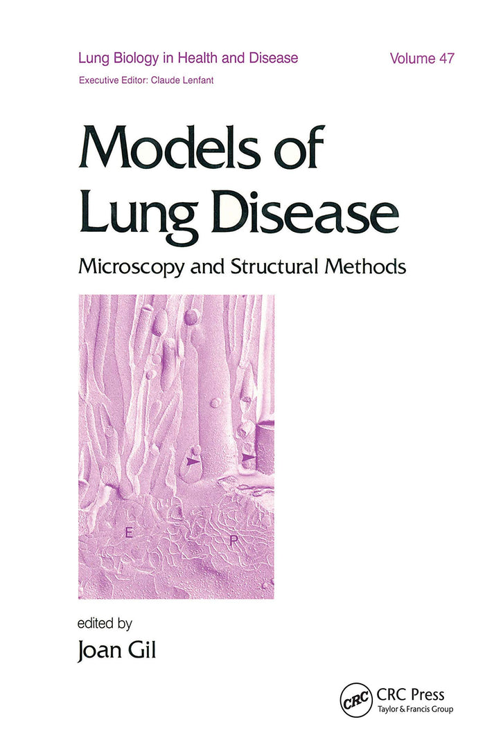 Models of Lung Disease: Microscopy and Structural Methods (Lung Biology in Health and Disease Book 47)