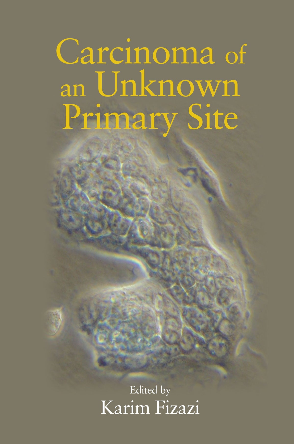 Carcinoma of an Unknown Primary Site: 1st Edition