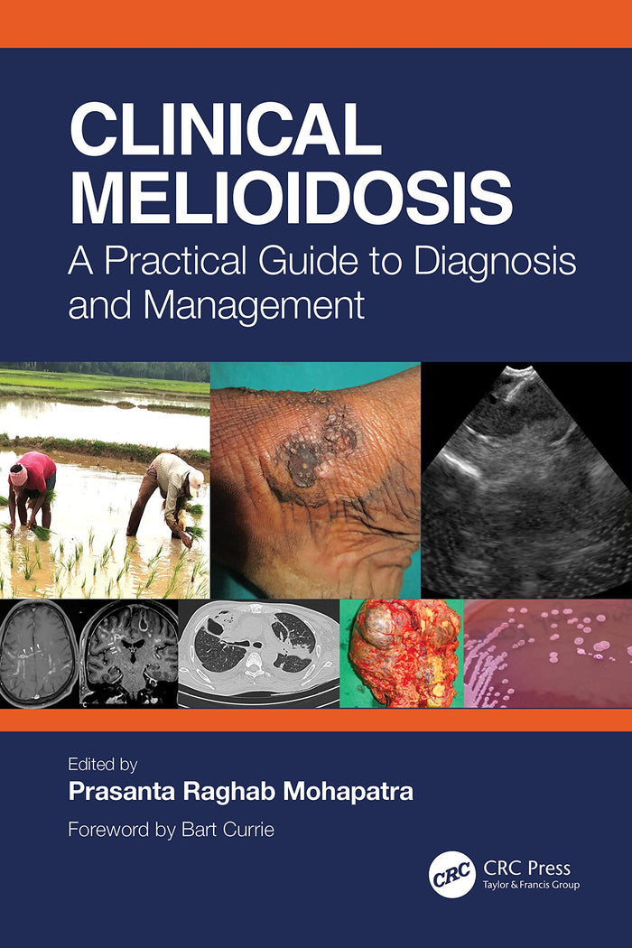 Clinical Melioidosis: 1st Edition
