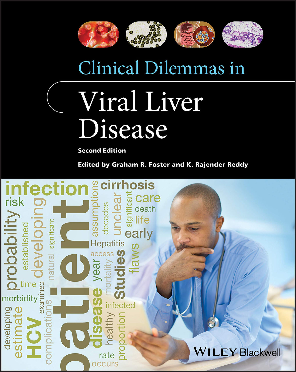 Clinical Dilemmas in Viral Liver Disease (Clinical Dilemmas (UK)): 2nd Edition