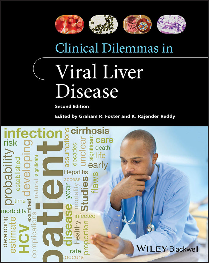 Clinical Dilemmas in Viral Liver Disease (Clinical Dilemmas (UK)): 2nd Edition