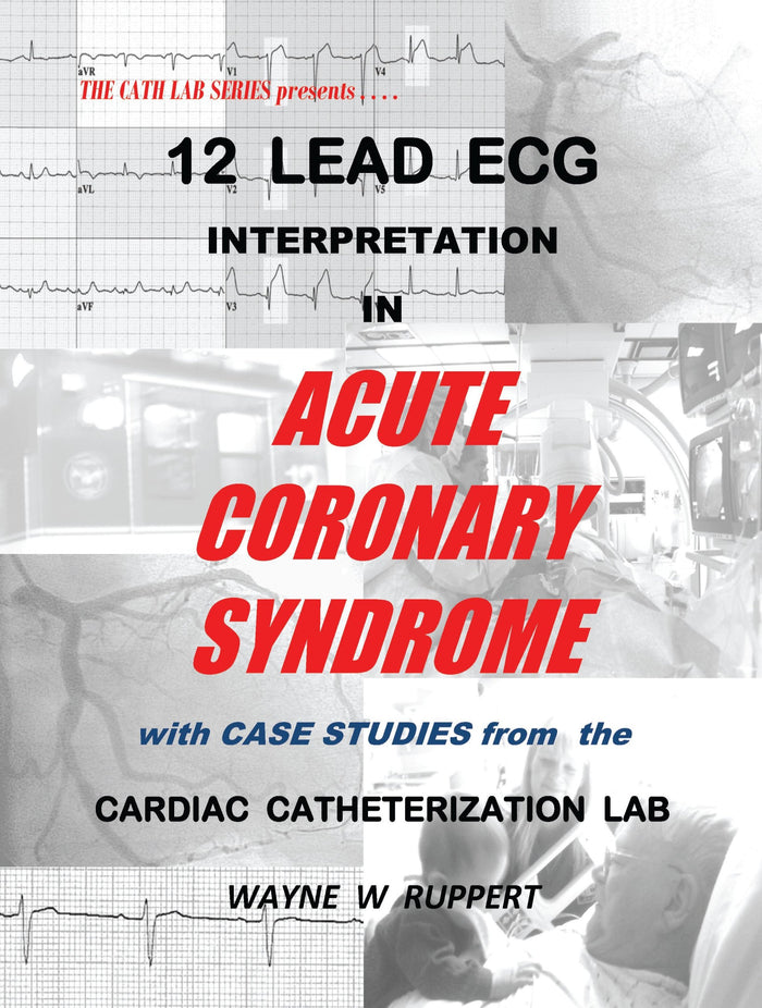 12 Lead ECG Interpretation in Acute Coronary Syndrome with Case Studies from the Cardiac Catheterization Lab: First Edition